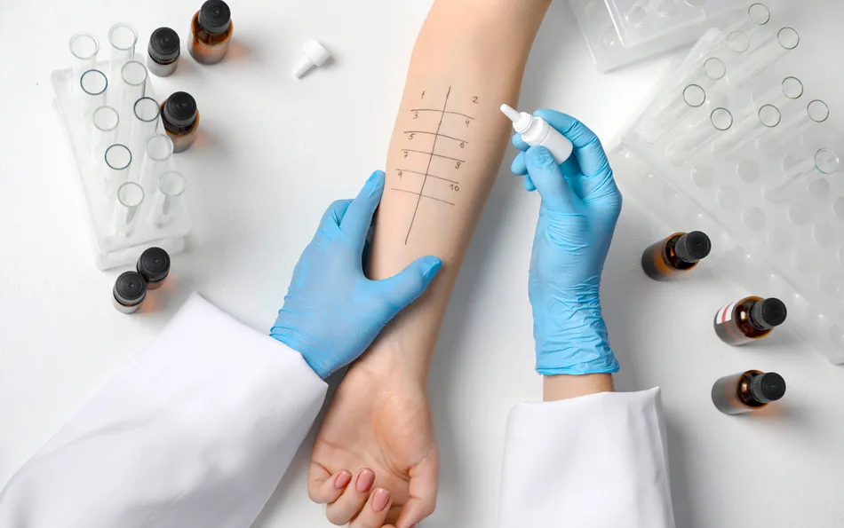 An einem Arm wird ein Pricktest druchgeführt