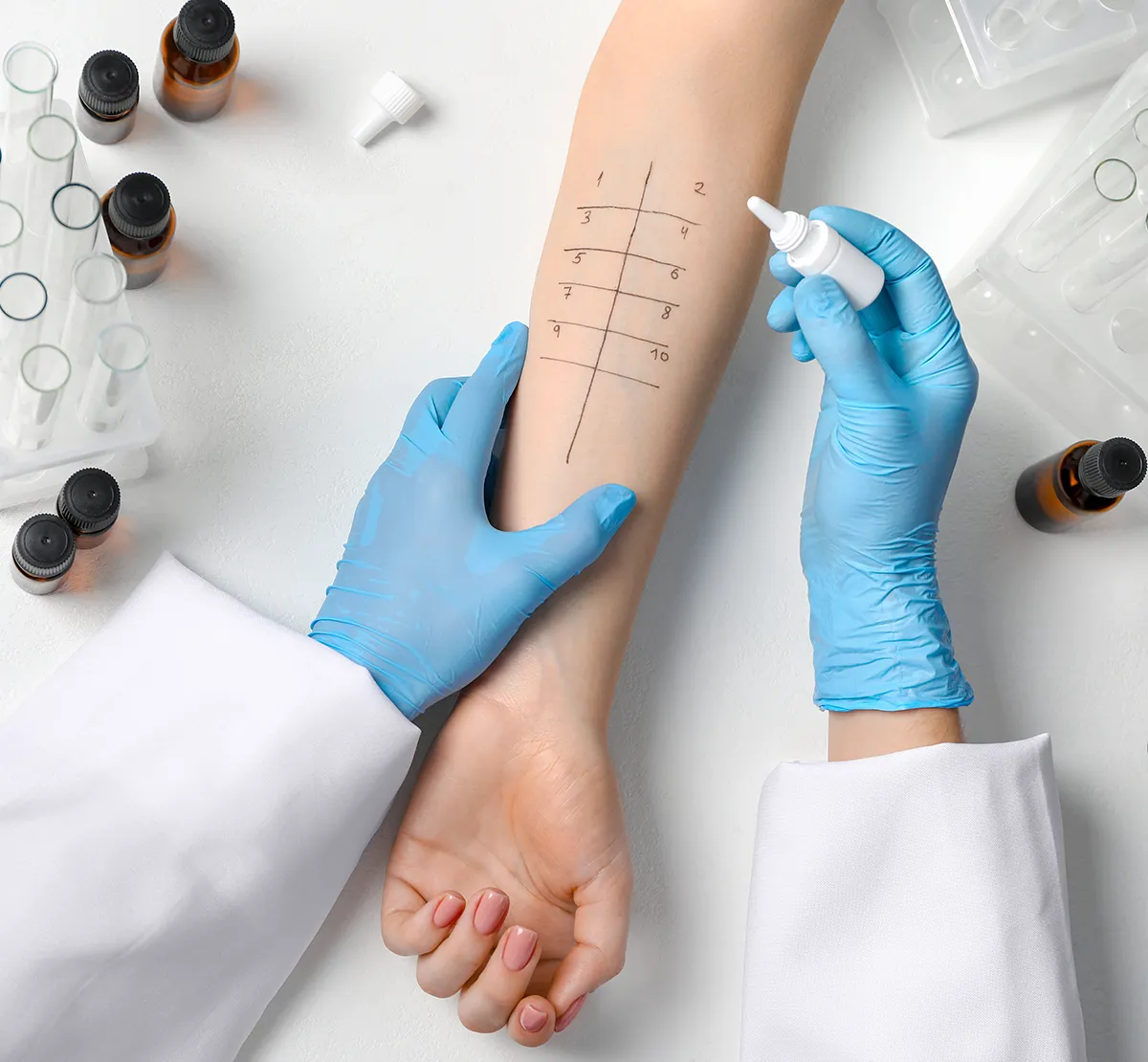 An einem Arm wird ein Pricktest druchgeführt. Drum herum sind Reagenzgläser in Haltern