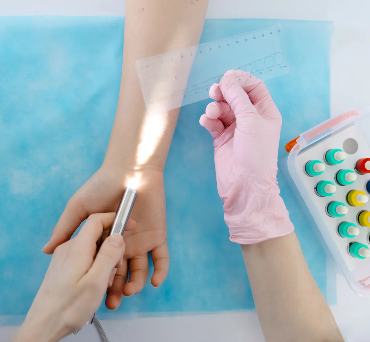 Allergietest Pricktest Anwendung Arm wird mit einer Lampe angeleuchtet und ein Vergleichsmuster wird daneben gehalten. Im Hintergrund sind Probstoffe in Gläsern abgefüllt