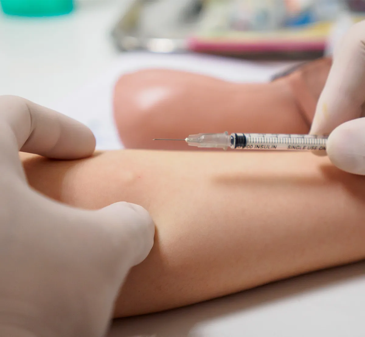 Intradermal Test zur Allergiediagnose Eine benutzte leere Insulinspritze wir dvor einem vor einem Arm in Handschuhen gehalten in Nahaufnahme